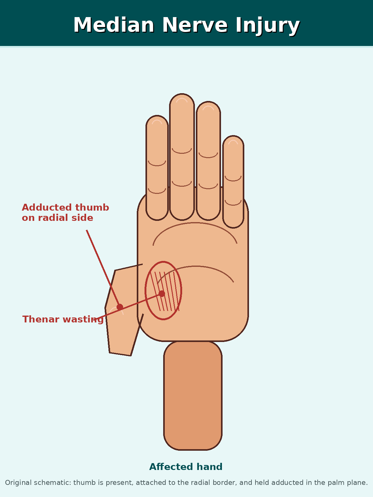 The diagram is not helpful