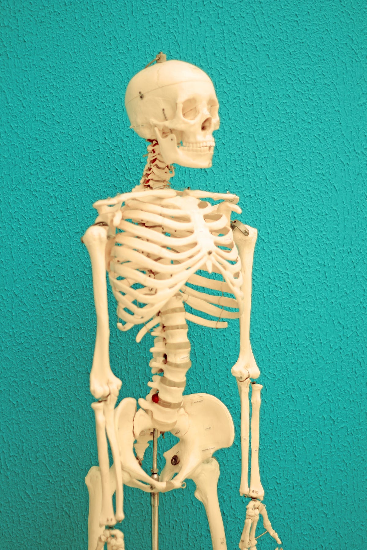 Building Strong Bones: Strategies for Managing Osteoporosis.