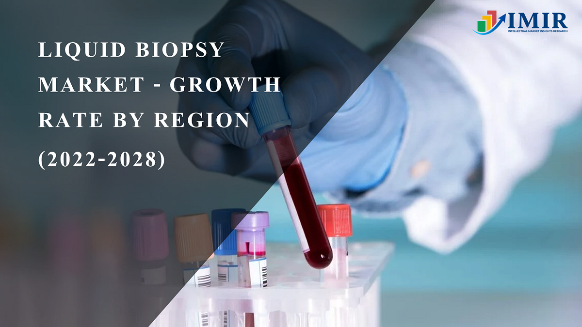 Liquid Biopsy Market is Booming with Strong Growth Prospects Roche