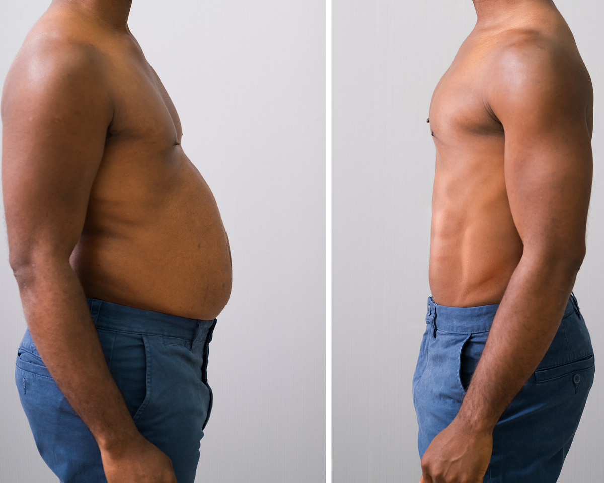 What is Body Composition?. How to undergo a body and