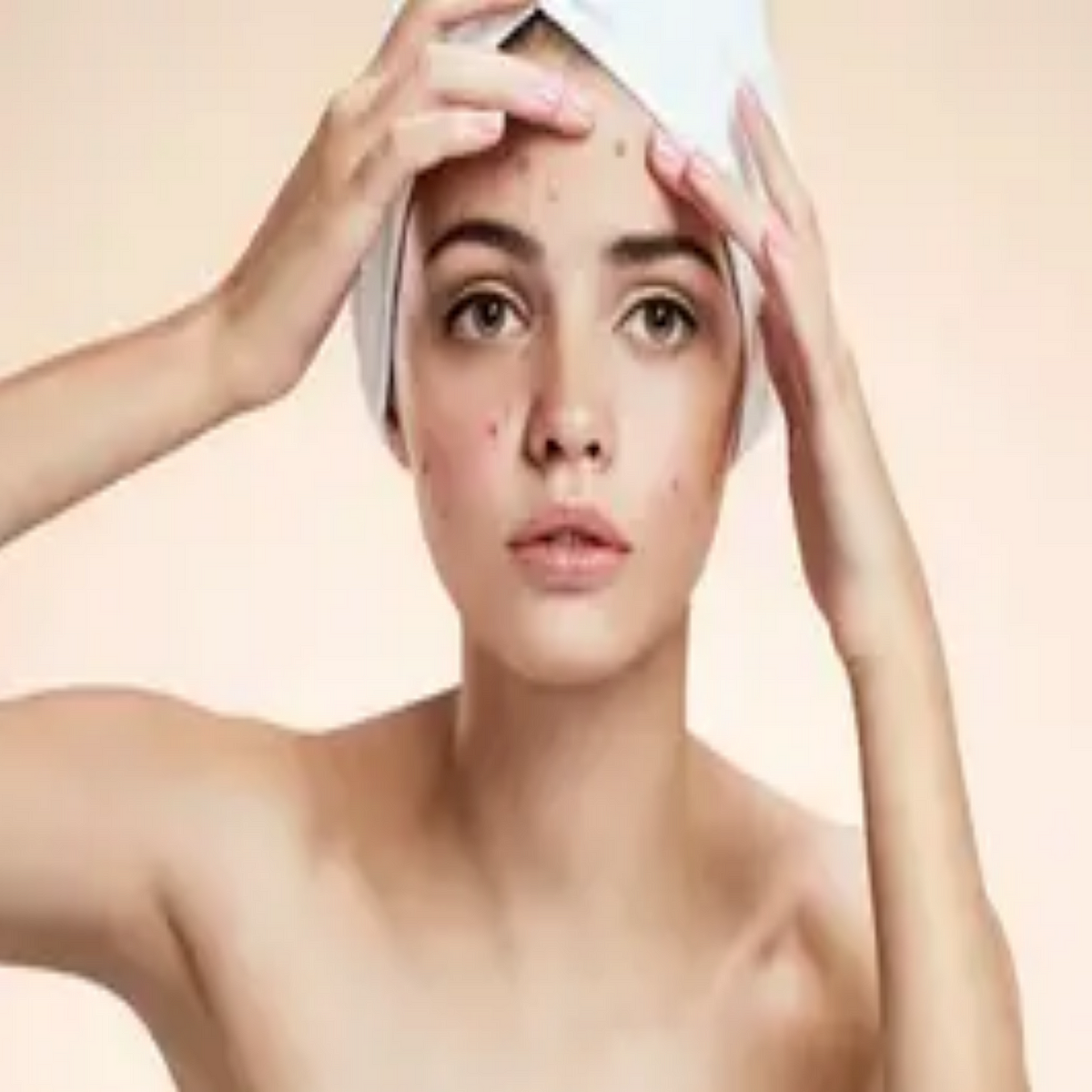 Here is a comprehensive guide to removing pimples and achieving clear, radiant skin:  by 