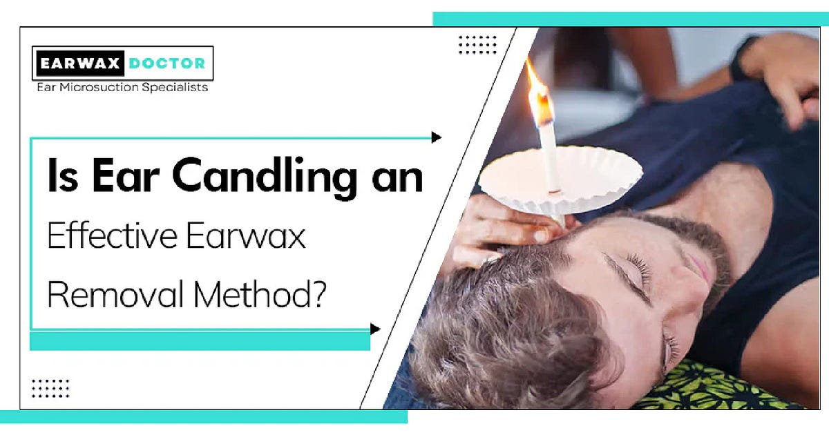 Ear Candling An Effective Way to Remove Earwax by Earwax Doctor