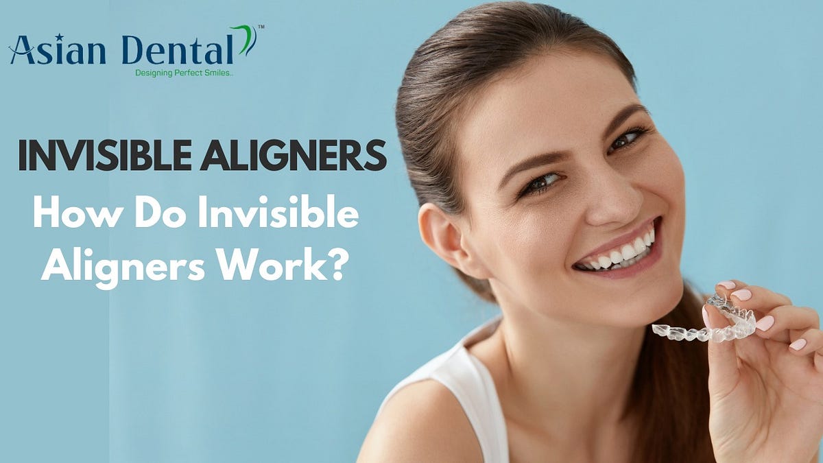 How Do Invisible Aligners Work Asian Dental Hospital Asiandentalhyd