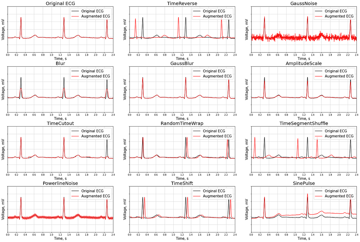 Ecgmentations is a library for ECG augmentation by Rostepifanov Medium