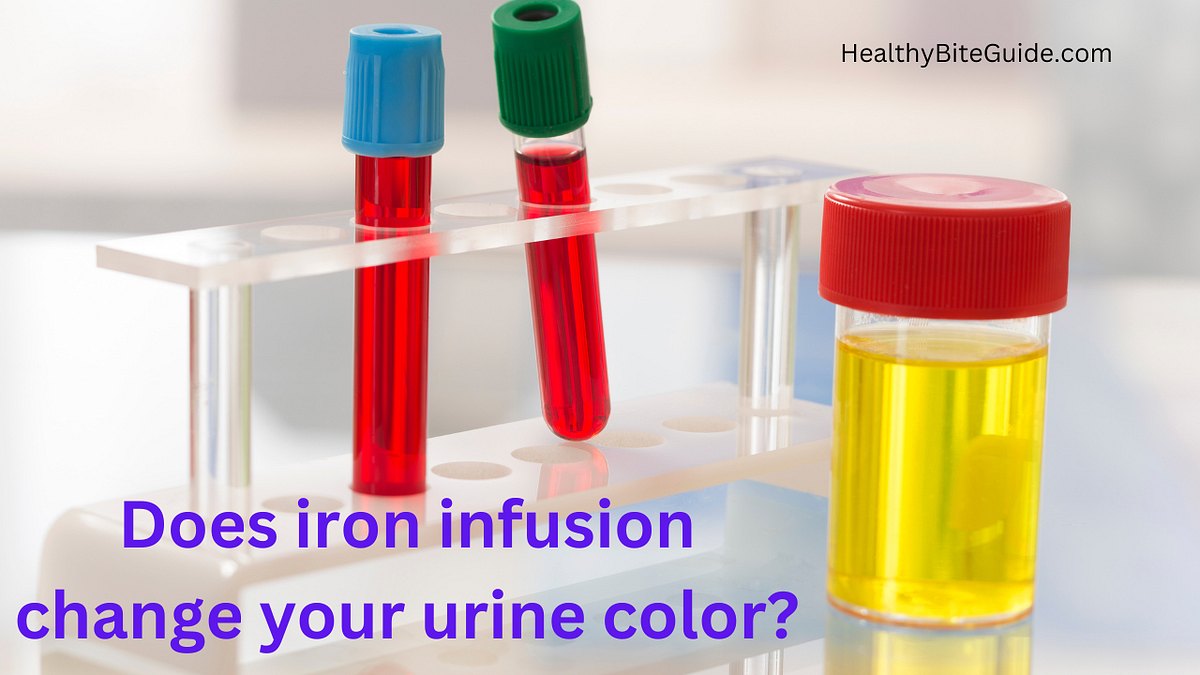 Does iron infusion change your urine color? by Healthy Bite Guide Medium