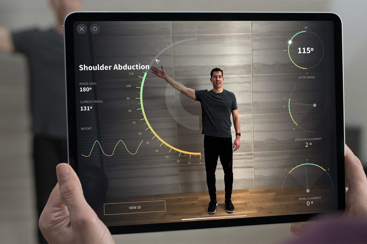 Технология LIDAR. Сканер LIDAR — это импульсный лазер… | by DesignGlory ...