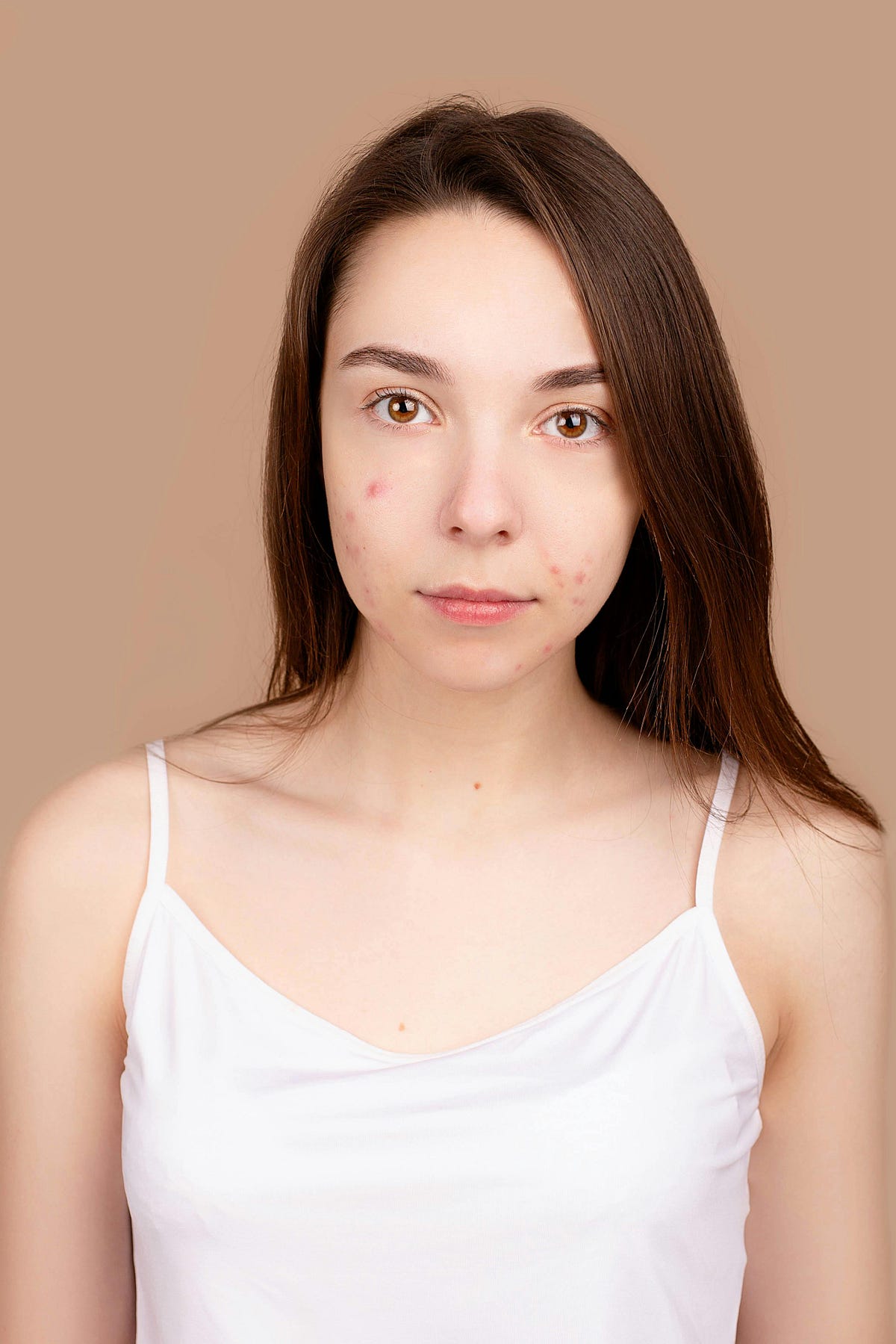 The Big Blackhead Battle: Your Weapon Against Breakouts - miqg6b3