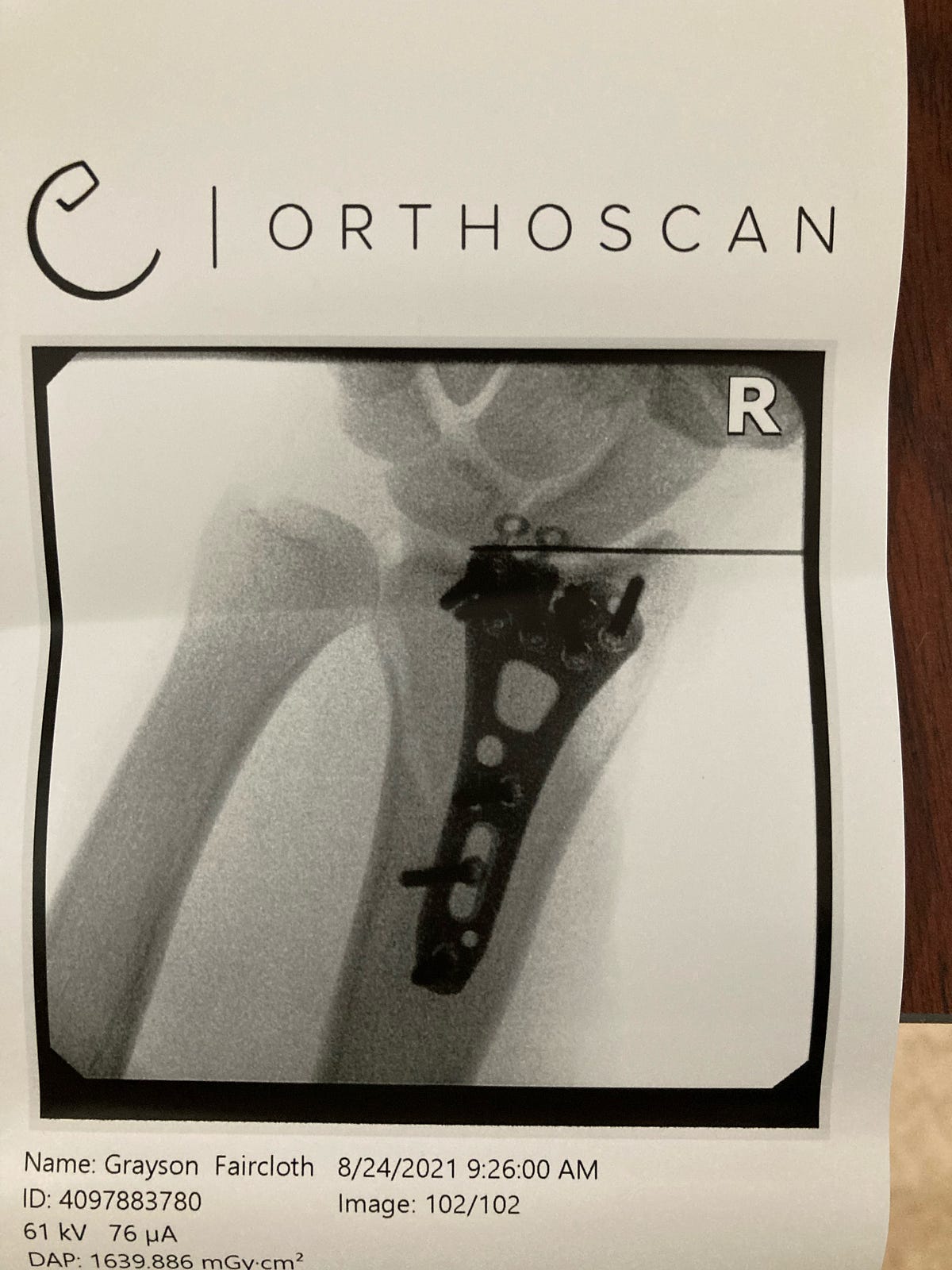 Learning to ride a motorcycle (and breaking my wrists) by Grayson