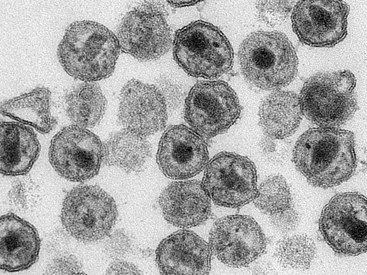 Understanding HIV/AIDS: Progress, Challenges, and Hope | by Chibuko ...