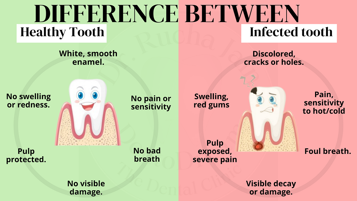 Unveiling the Tale of Healthy tooth vs Infected tooth | by Dr Rucha ...