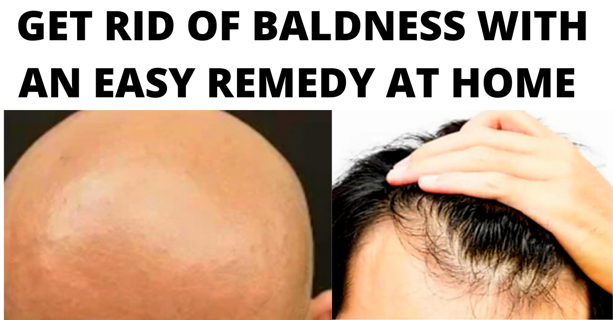 An easy remedy to get rid of baldness grow hair faster Saleem Ahmed