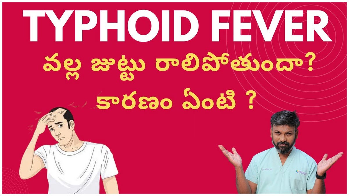 Hair loss due to typhoid fever, will I regrow hair again? Dr John