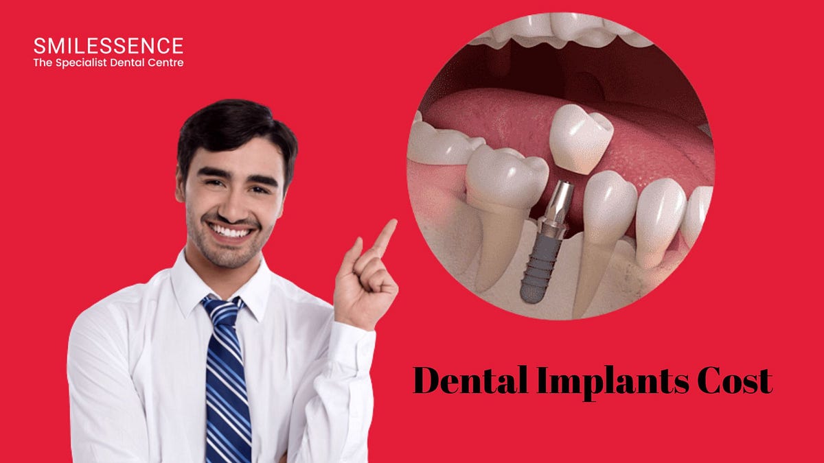 Dental Implants Cost in Gurgaon Smilessence Medium