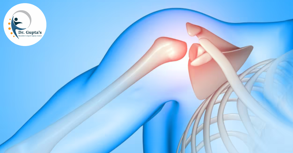 Shoulder Arthroscopy What to Expect Before, During, and After Surgery