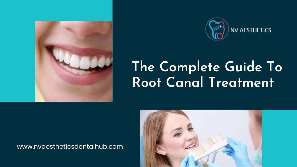 The Complete Guide To Root Canal Treatment by NV Aesthetics And Dental Hub Medium