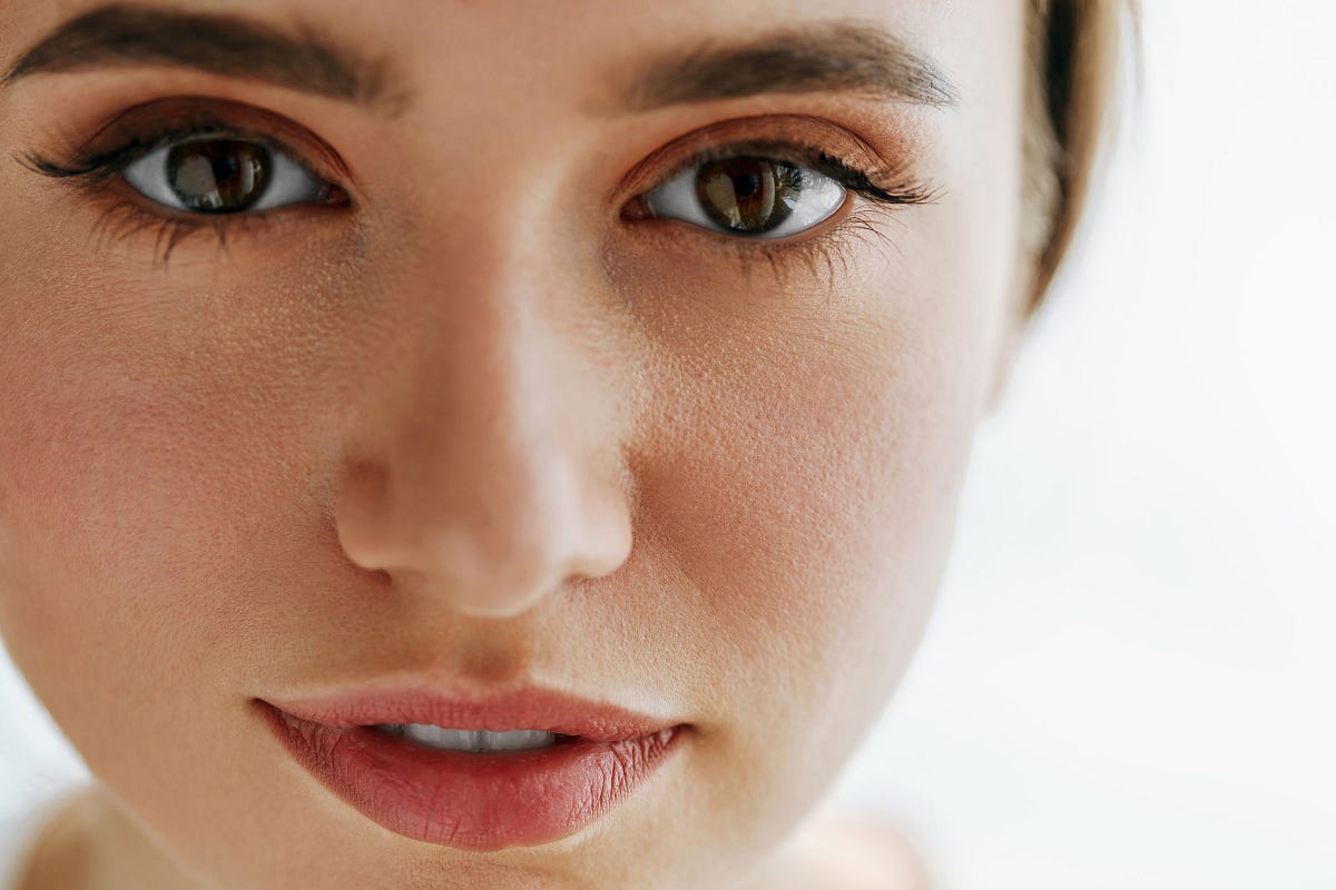 How to treat under eye fillers. BAGS UNDER THE EYES, TEAR TROUGHS AND