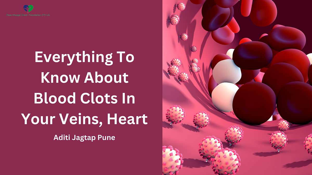 Everything To Know About Blood Clots In Your Veins, Heart by Aditi