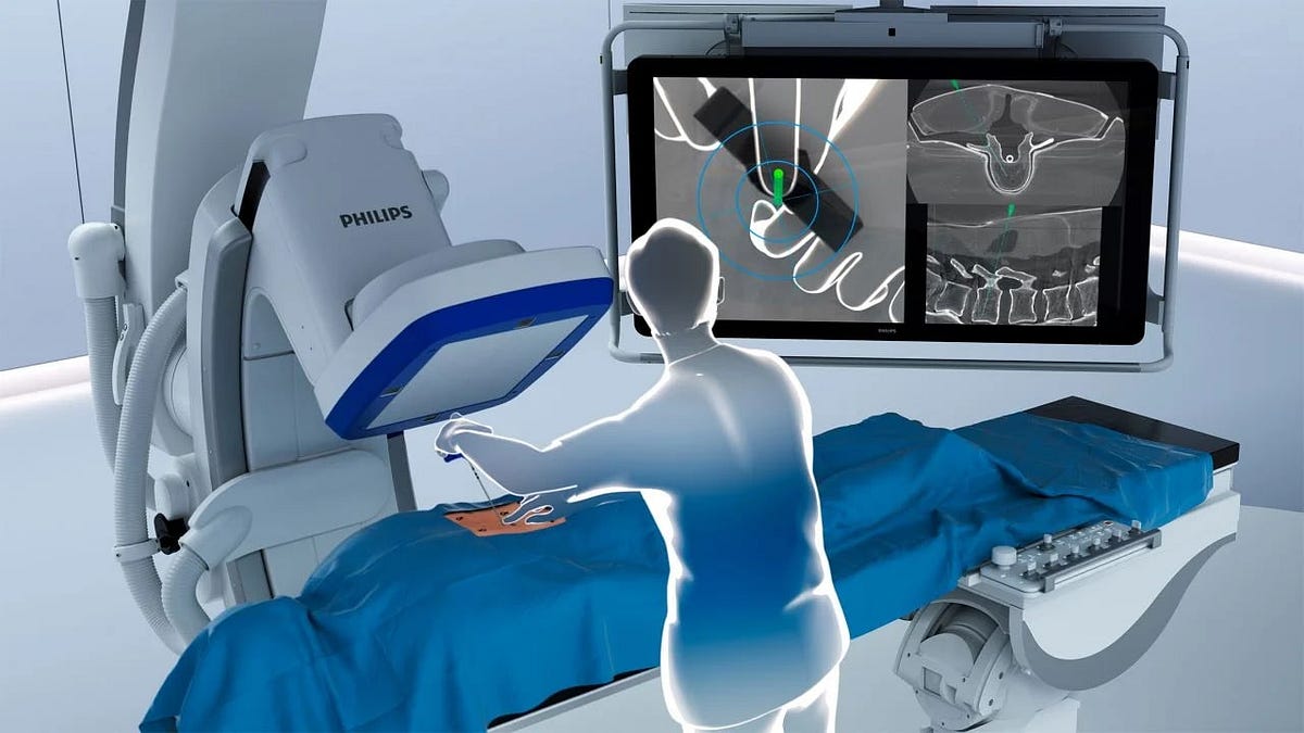 Surgical Navigation Systems Market New Study Of Trend And Forecast