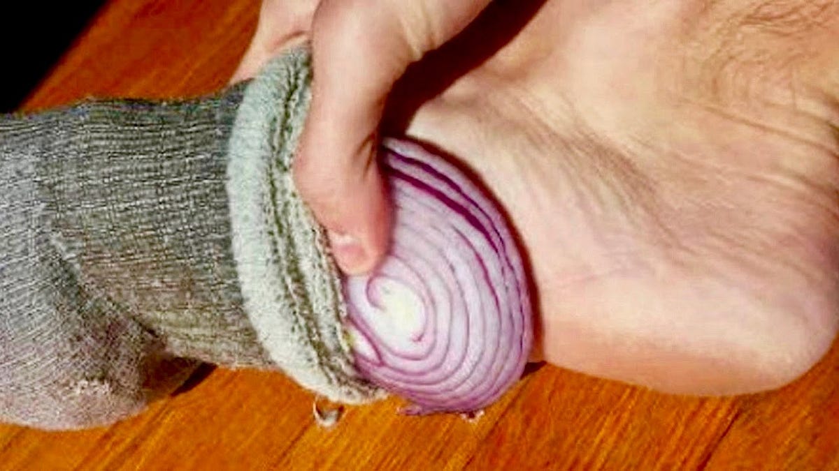 Onion in Sock: The Surprising Benefits of Putting Onion Slices in Your Socks  Overnight | by Kirui Kiptoo | Dec, 2023 | Medium
