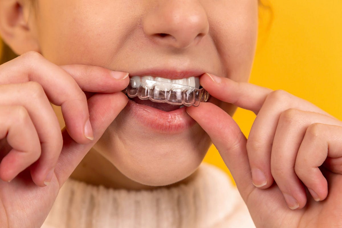 What is an orthodontic retainer?. An orthodontic retainer is a device