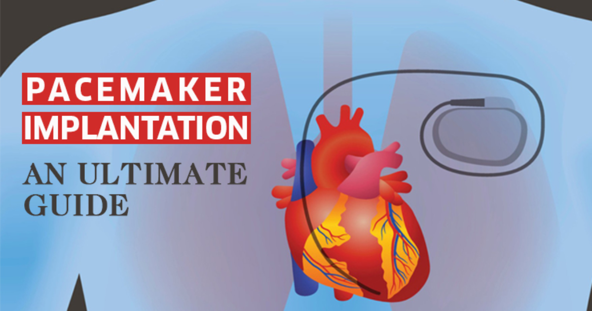 Types of Pacemaker — Heart Specialist Doctor by Drrakeshjainindore Medium
