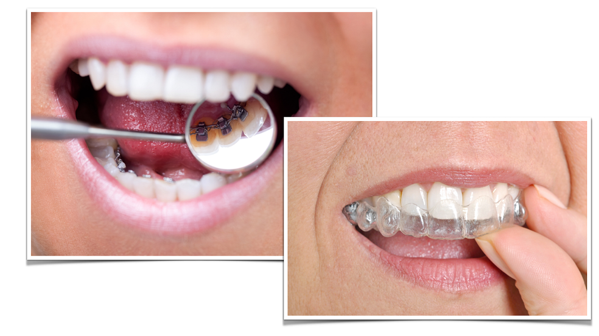 Selecting the best orthodontists? Here are some guidelines by jan