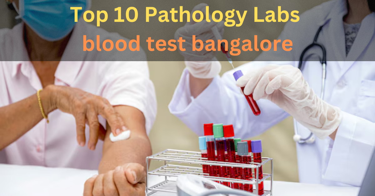 Top 10 Pathology Labs blood test bangalore by Oncquestlabs Jun