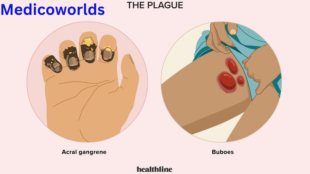 How does the bubonic plague spread, and what are the modes of