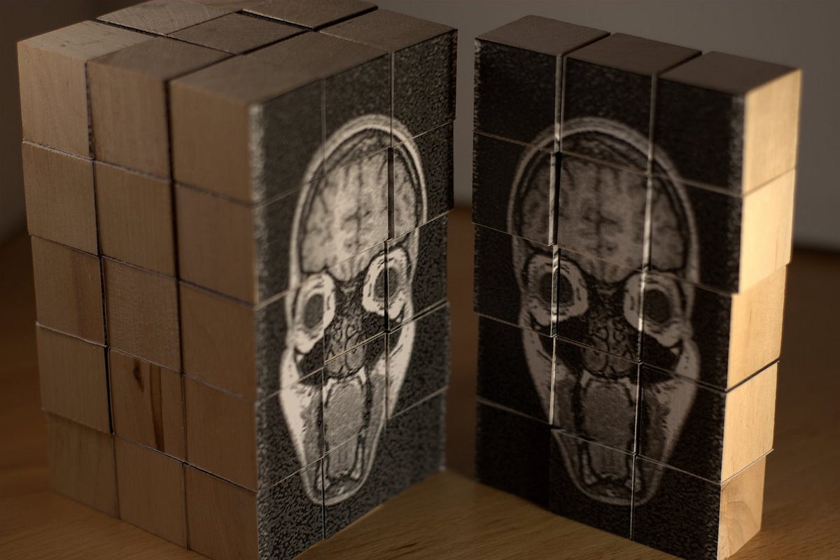 The Things in My Head — Making Sense of an ADHD Diganosis by