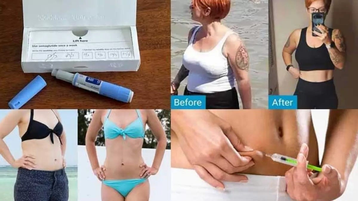 Ozempic Weight Loss Transformations Captured In Before And After 