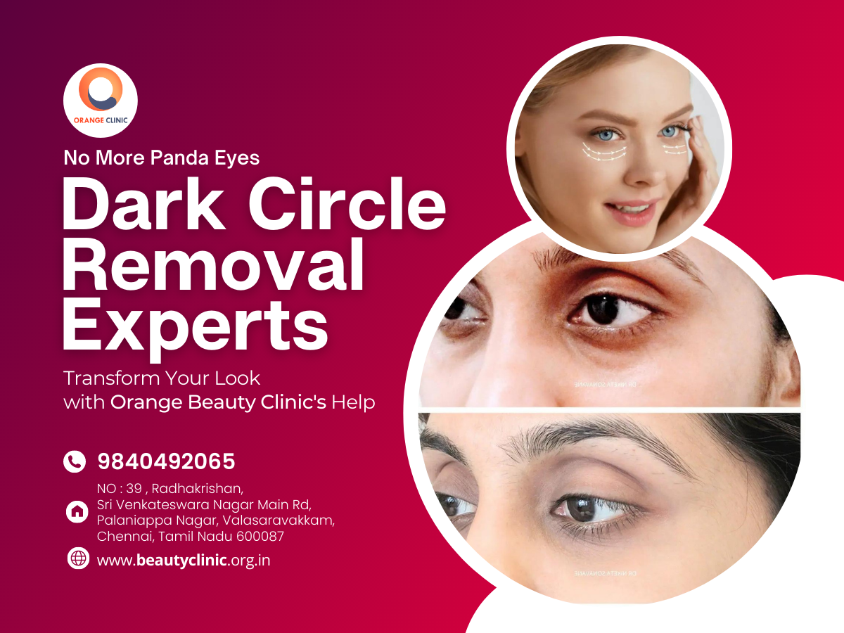 Expert Dark Circles Removal in Valasaravakkam, Chennai by Orange