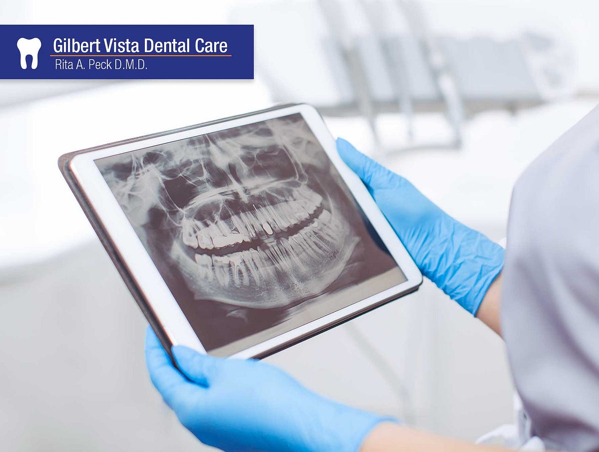 Affordable Preventive Dentistry XRays in Gilbert Drritapeck Medium