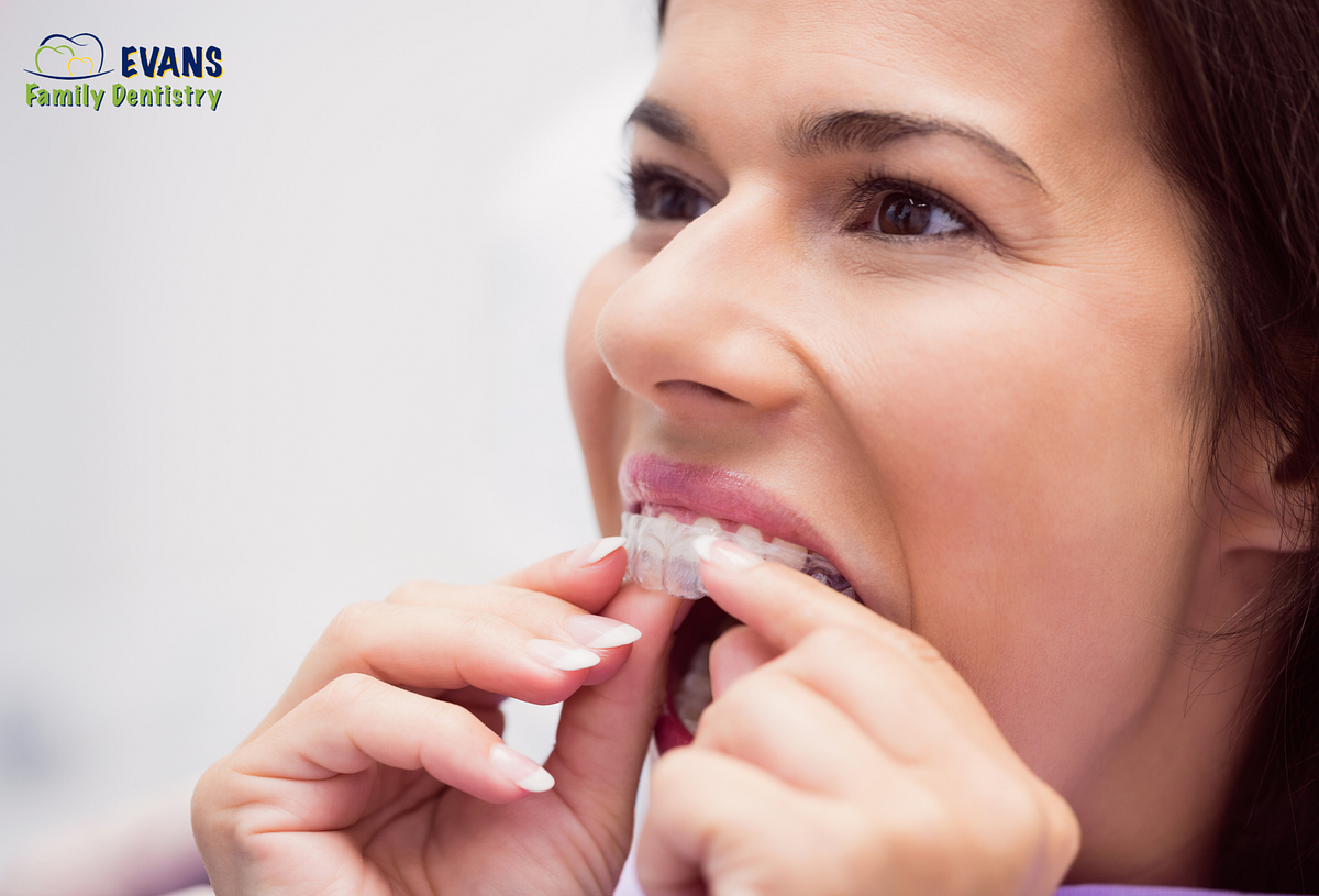 Choosing Your Smile Makeover Invisalign vs. Veneers Comparison Medium