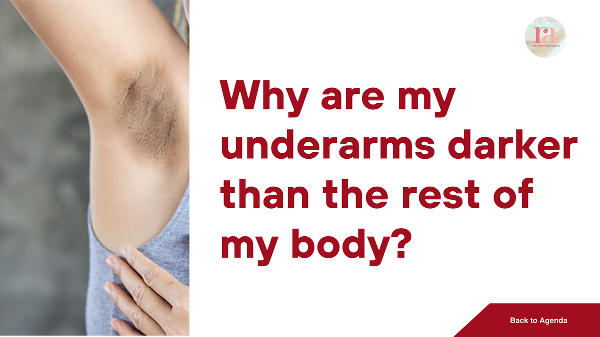 Why are my underarms darker than the rest of my body? by Rakshaa