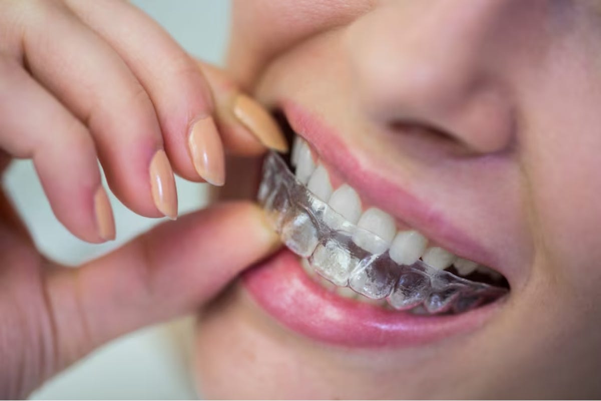How to Prepare for Invisalign Treatment? | by Dental Wellness Journey ...