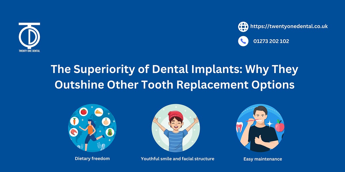 Superiority of Dental Implants Why They Outshine Other Tooth Replacement Options. by Mark Superiority of Dental Implants Why They Outshine Other Tooth Replacement Options. by Mark