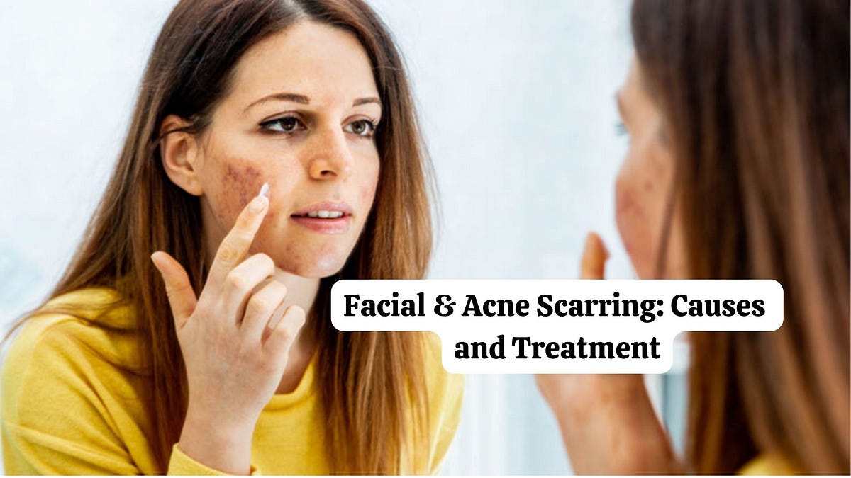 Facial & Acne Scarring Causes and Treatment by Citrineclinic Dec, 2023 Medium