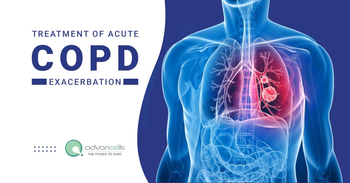 The Available Treatment of Acute COPD Exacerbation by Advancells Medium