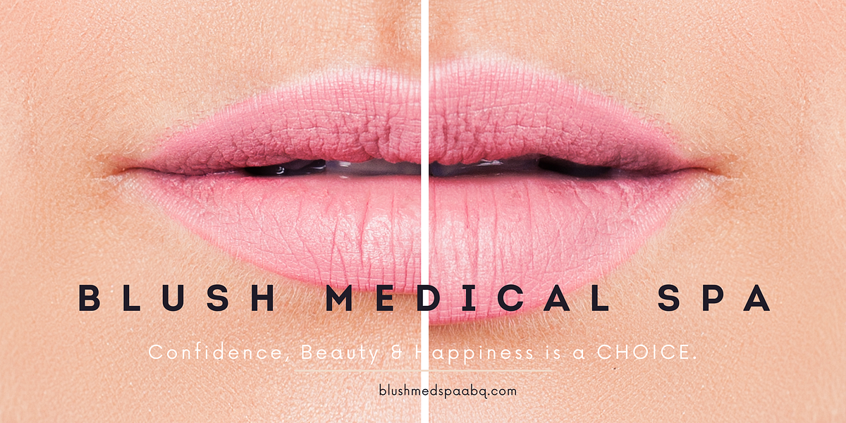 The Difference Between Lip liner and Lip filler by Blush Medical Spa