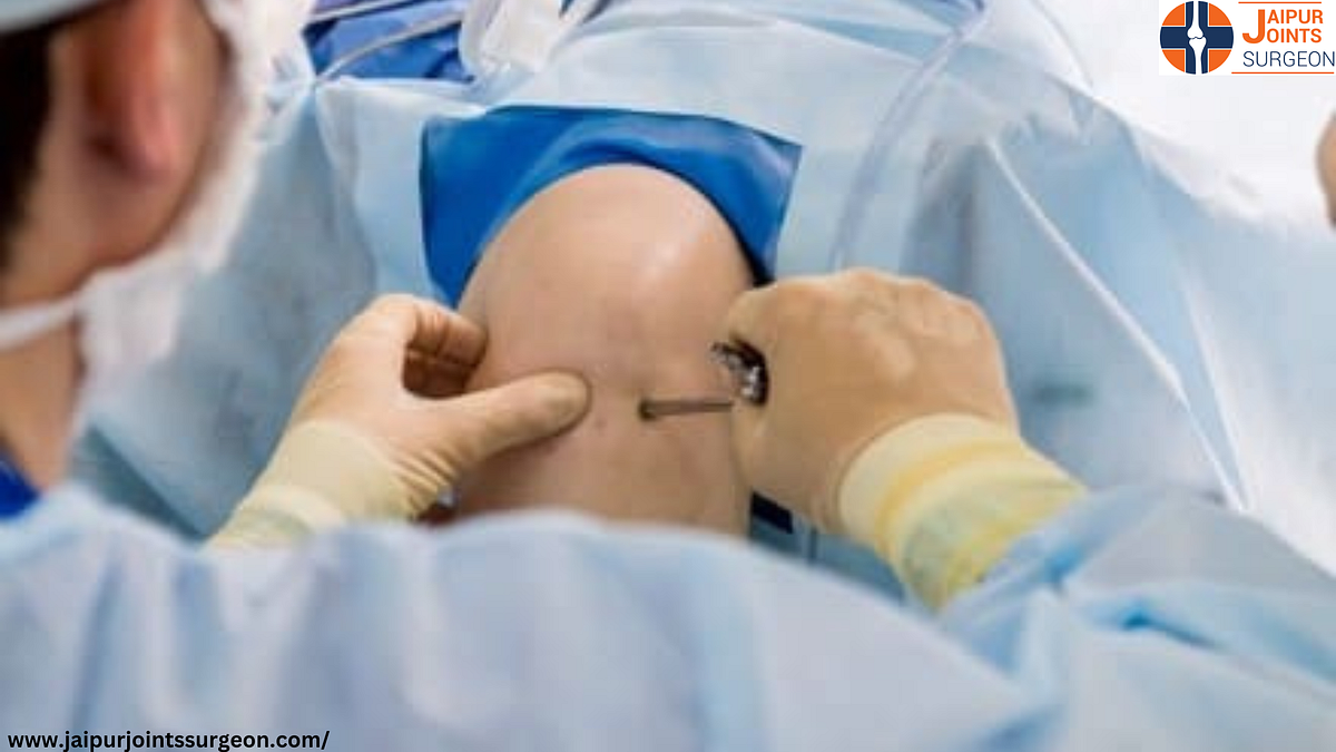 Best Arthroscopy Surgeon In Jaipur — Hip Replacement Surgeon
