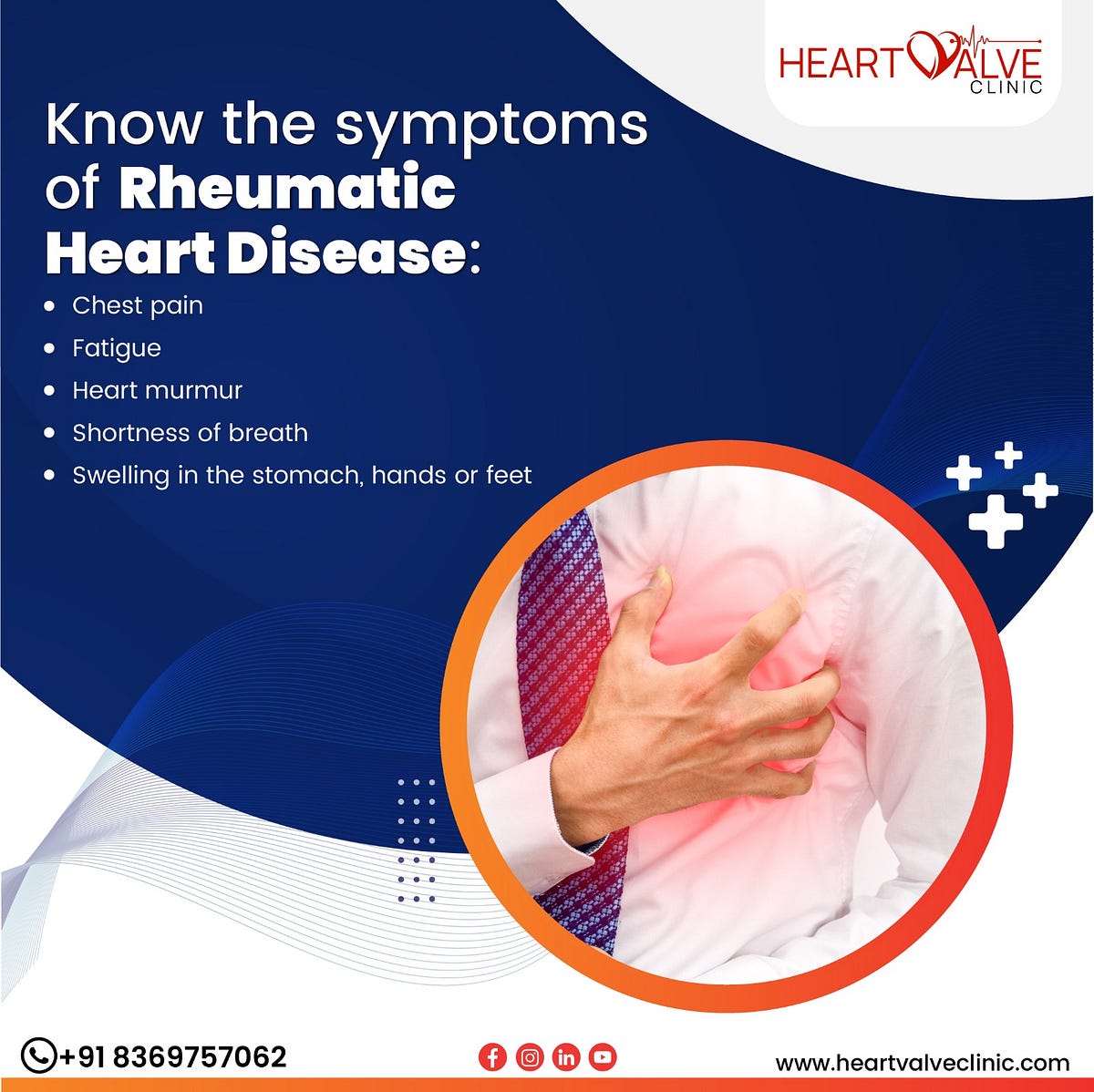 Rheumatic heart disease is main cause of heart valve disease. - Heart ...