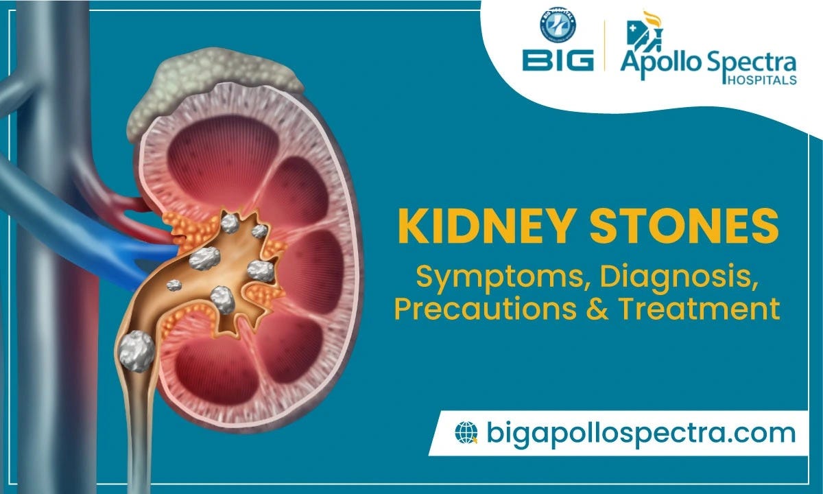 Kidney Stone Symptoms And Embracing Healthy Eating Habits For Better 
