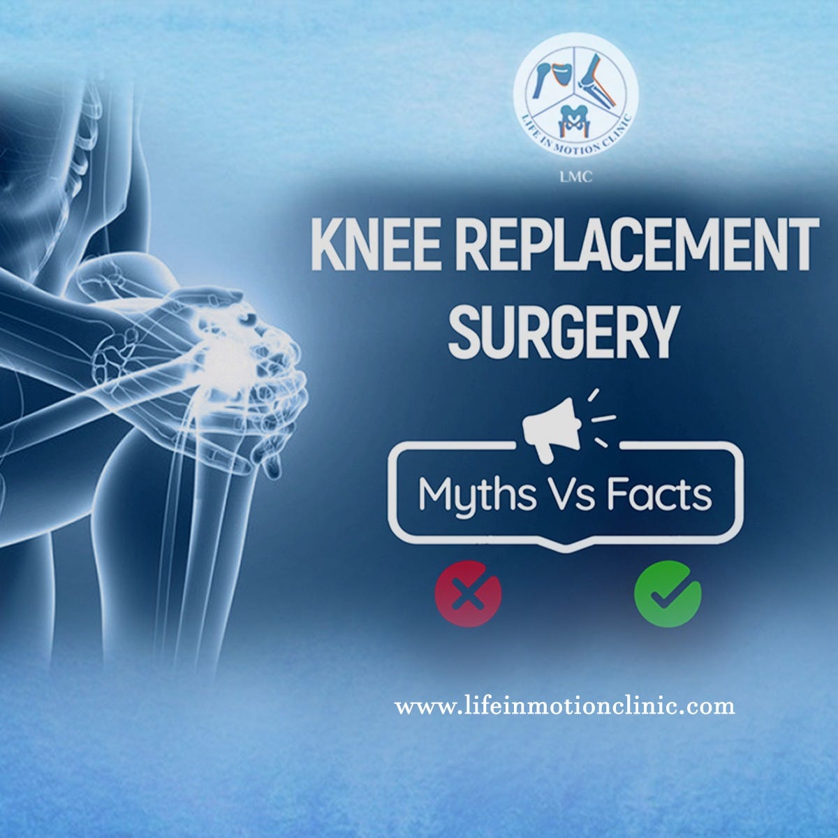 Dr. Rahul Sharma the best shoulder replacement surgeon in Delhi by