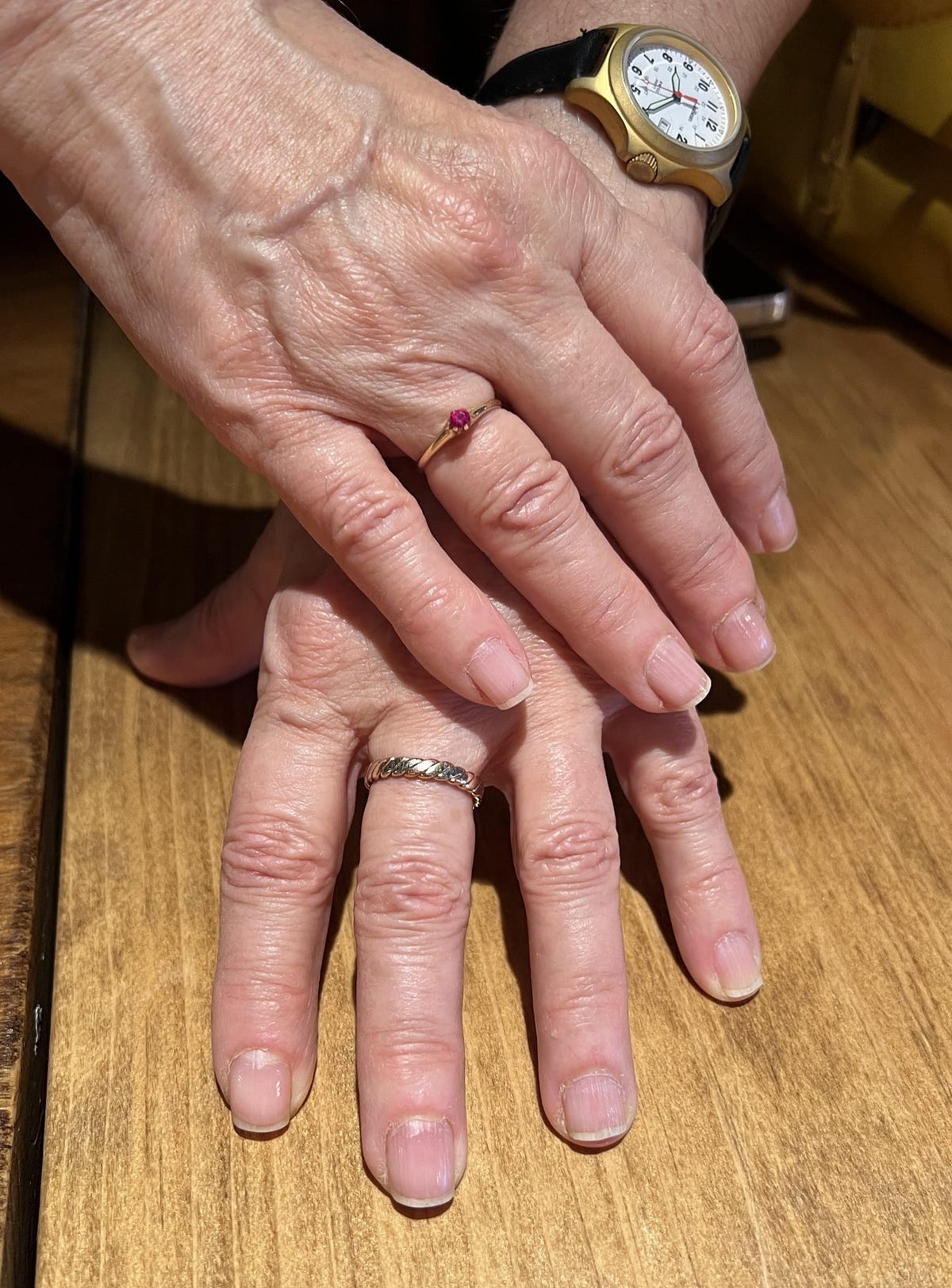 The Practical Mourner. When to Stop Wearing Your Wedding Ring? by
