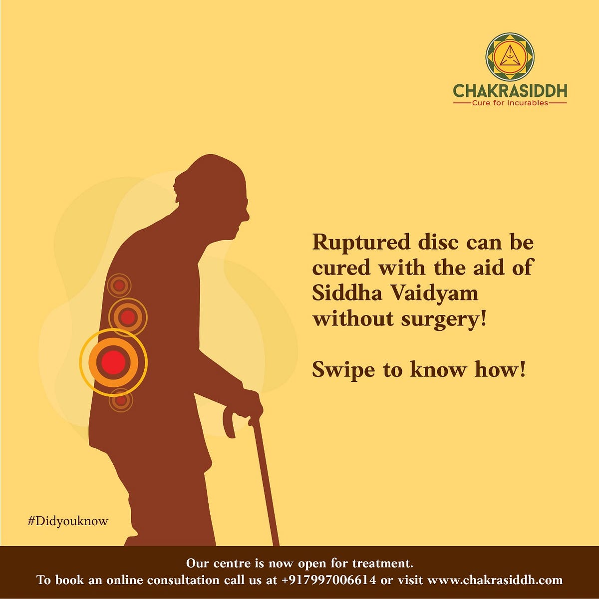Is a Slip Disc Curable?. What is a slipped disc? by Chakra Siddh Medium