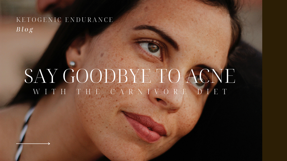 Can the Ketogenic Diet Cure Acne? (+11 Mistakes to Avoid for ... - GoodGlow
