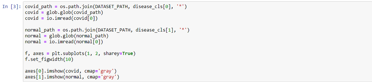 Corona Detection AI model using chest X-Rays | by Saurabh Parmar | Medium