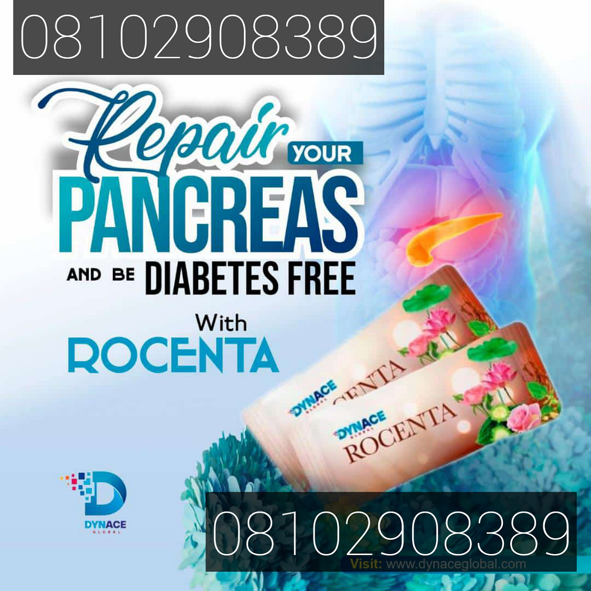 Diabetes is a chronic disease that occurs either when the pancreas does
