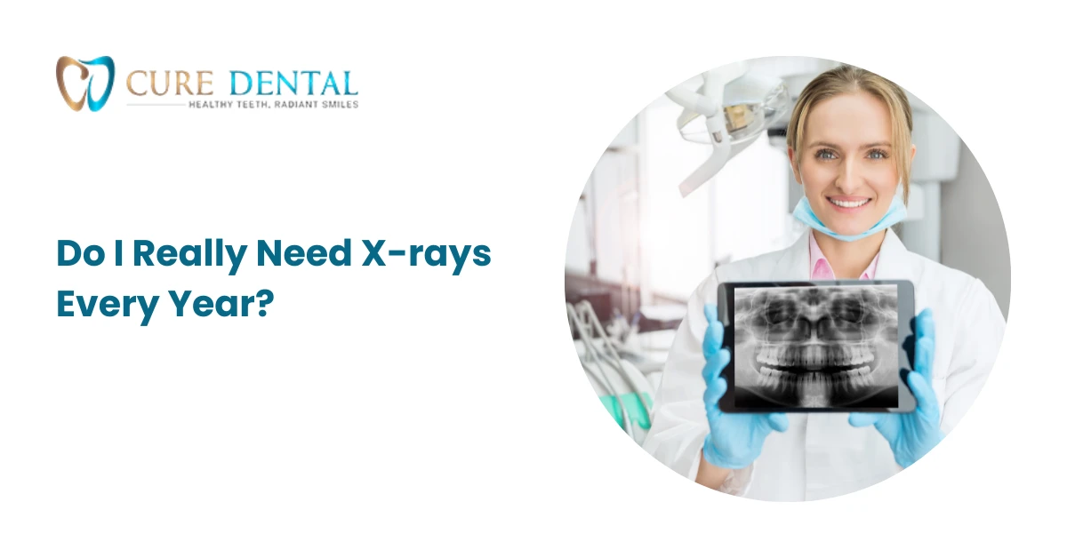 Do I Really Need Xrays Every Year? by Curedentalbeltontx Medium