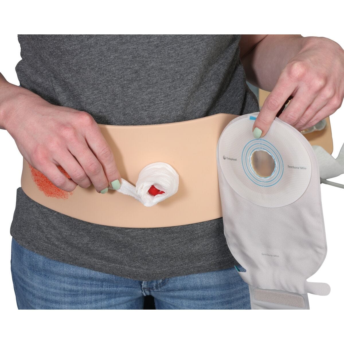The future of the ostomy devices market looks promising, driven by innovations in medical…